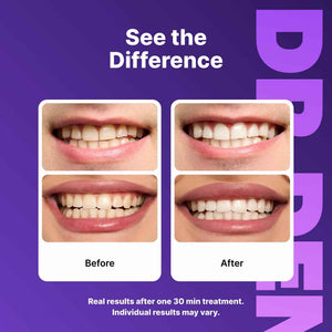 DRDENT Purple Teeth Whitening Strips 21 Treatments - Safe for Enamel - Non Sensitive Teeth Whitening