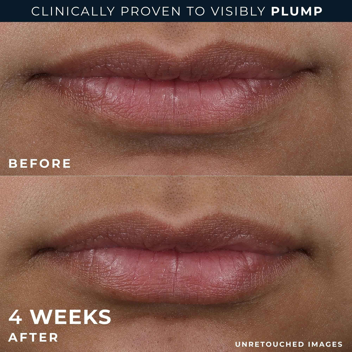 RoC Derm Correxion Lip Volumizer - Lip Plumper Peptide Treatment with Hyaluronic Acid & Vitamin E + Line Smoothing Eye Cream Packette